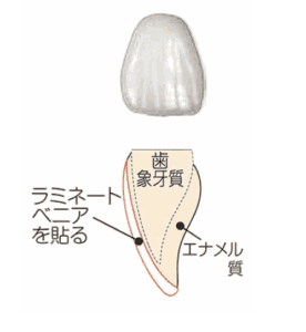 ラミネートベニヤのイメージ